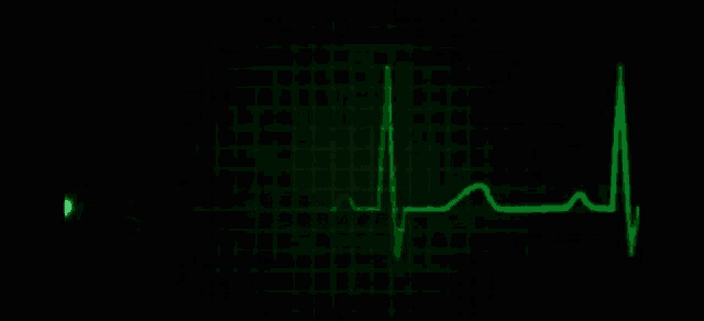 flatline-flat.gif